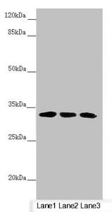 CENPK Antibody