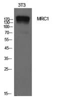 Mannose Receptor / CD206 Antibody