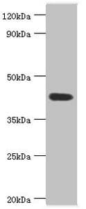 Polyclonal Rabbit anti-Human ASAH1 / Acid Ceramidase Antibody (aa146-395, IHC, WB)