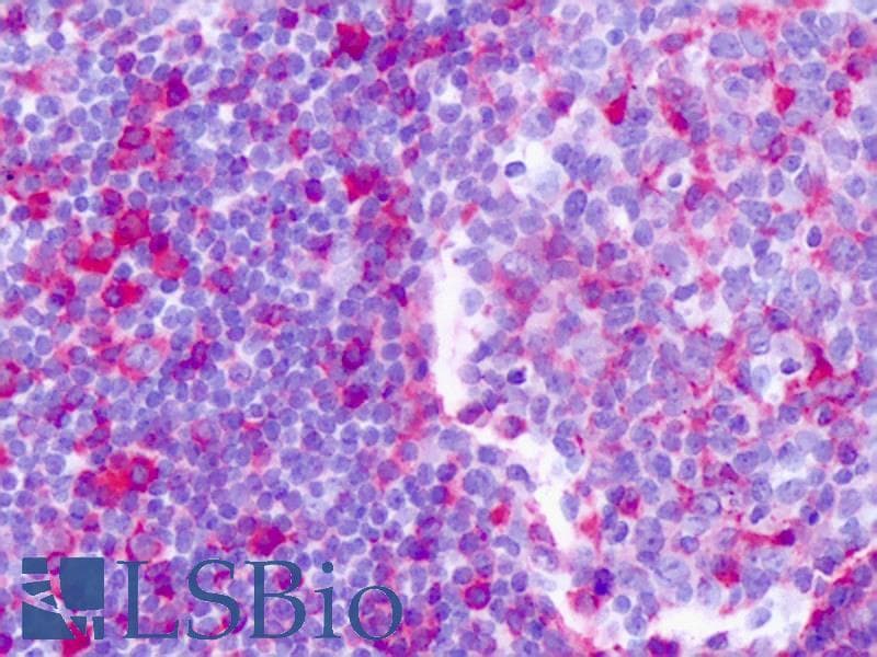 F2RL2 / PAR3 Antibody (Internal)