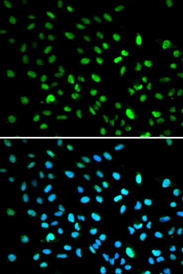 IHC-plus™ Polyclonal Rabbit anti-Human DDIT3 / CHOP Antibody (IHC, IF, WB)