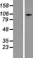 EXOSC10 Protein (Over-Expression Lysate Myc-DDK (Flag))