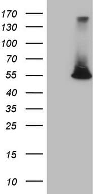 ESRRA / ERR Alpha Antibody (aa1-205, clone OTI1E6)