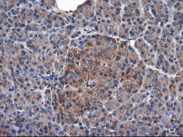 TUBAL3 Antibody (clone OTI4C5)