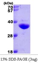 Human NQO1 Protein (Recombinant His)