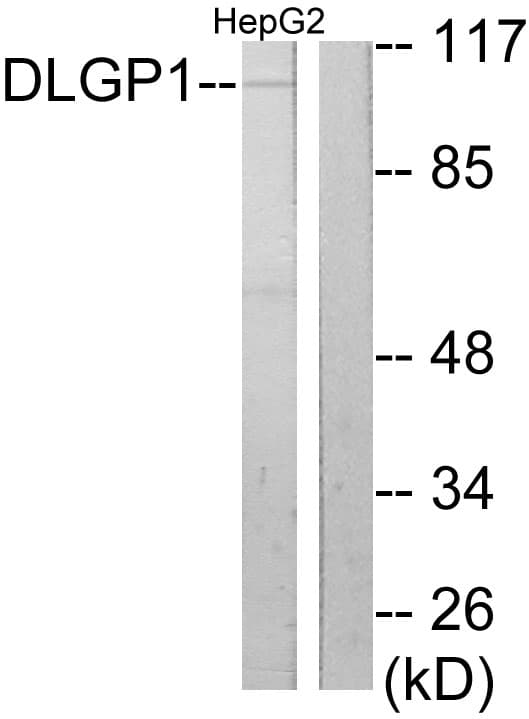 DLGAP1 Antibody (aa791-840)