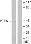 Polyclonal Rabbit anti-Human PTEN Antibody (C-Terminus, IHC, WB)