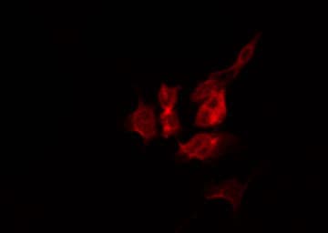 Polyclonal Rabbit anti-Human EIF2AK3 / PERK Antibody (IF, WB)