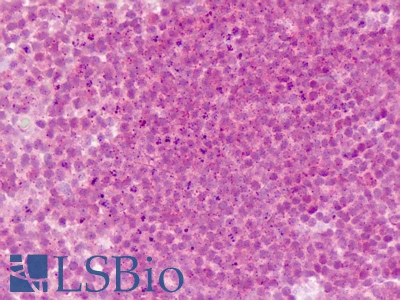 IHC-plus™ PDGFRA / PDGFR Alpha Antibody (Tyr762)