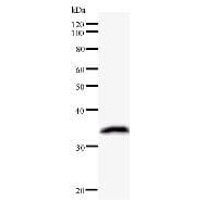KIF2C / MCAK Antibody (clone 2488C3a)