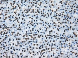 KIAA0153 / TTLL12 Antibody (clone OTI4B2)