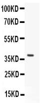 FOXO3 / FOXO3A Antibody (aa471-673)