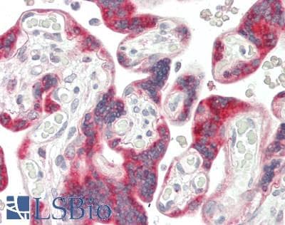 IHC-plus™ Monoclonal Mouse anti-Human PCF11 Antibody (clone 3G4, IHC, WB)