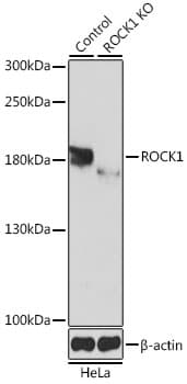 Rho Kinase / ROCK1 Antibody