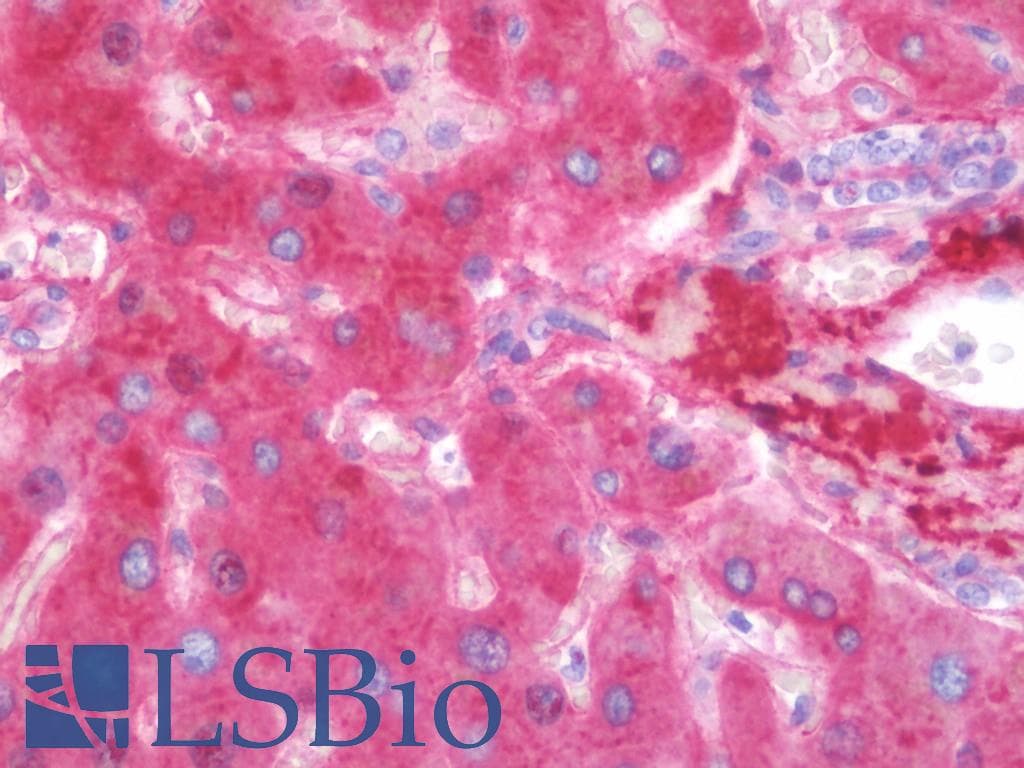 IHC-plus™ VTN / Vitronectin Antibody (aa1-310, clone 6F212)