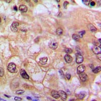 RELA / NFKB p65 Antibody (C-Terminus)
