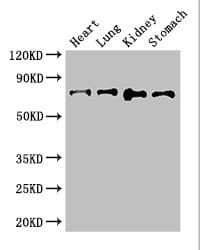 Polyclonal Rabbit anti-Human ABCG8 Antibody (IHC, IF, WB)