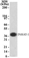 IHC-plus™ SET / TAF-I Antibody (aa66-81)