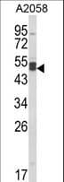 AGPAT3 Antibody (aa241-269)