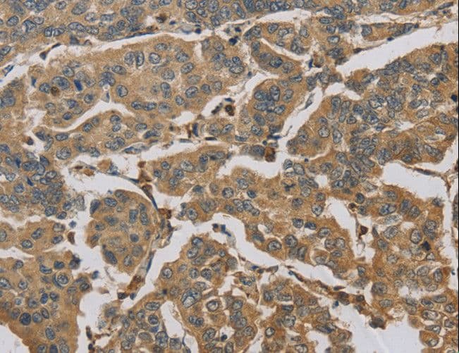 TS / Thromboxane Synthase Antibody