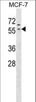 Polyclonal Rabbit anti-Human ZNF383 Antibody (aa103-129, WB)
