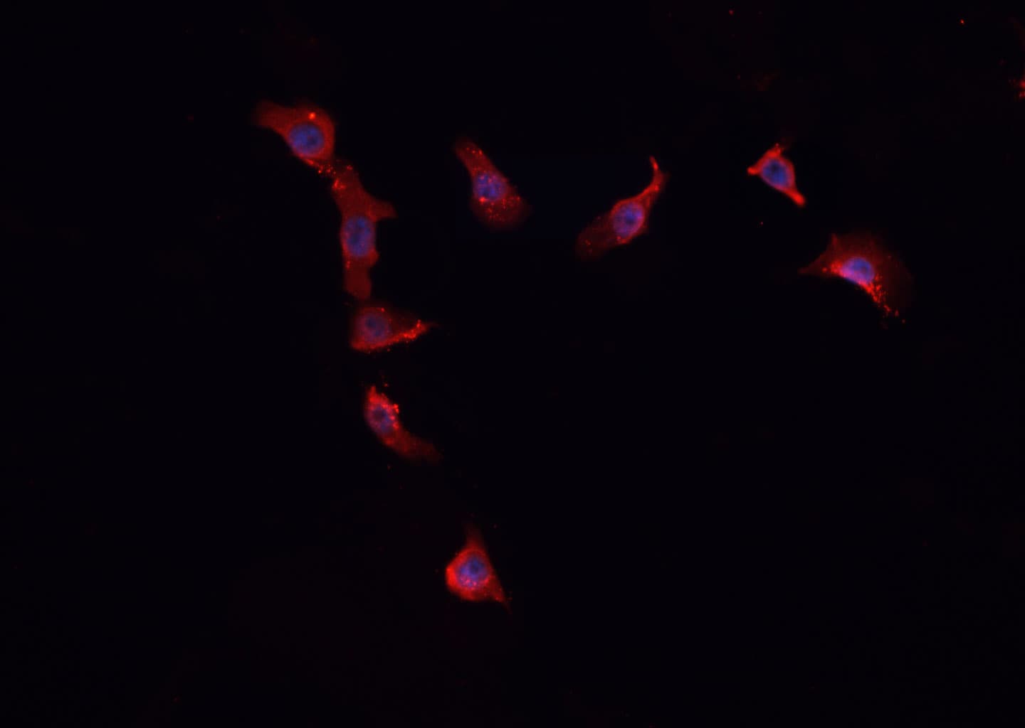 FBLN4 / EFEMP2 Antibody