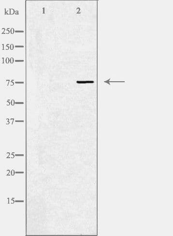 GLB1 / Beta-Galactosidase Antibody