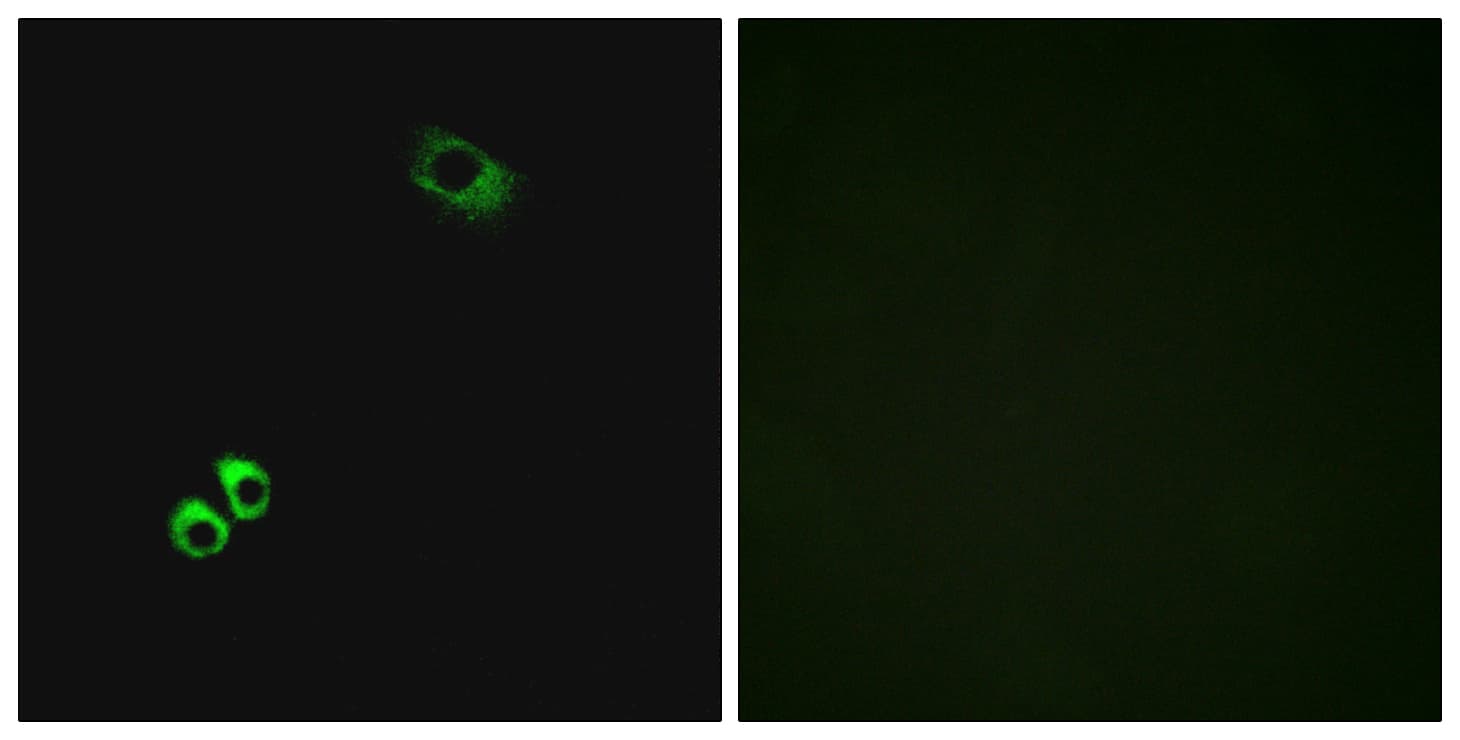 Polyclonal Rabbit anti-Human GPRC6A Antibody (aa471-520, IF, WB)