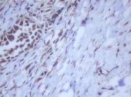 Monoclonal Mouse anti-Human DDX59 Antibody (clone OTI2G1, IHC, WB)