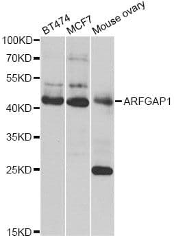 ARFGAP1 Antibody