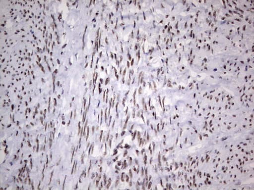 Monoclonal Mouse anti-Human HDAC9 Antibody (clone OTI7G2, aa181-460, IHC, WB)