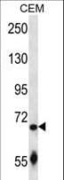 Polyclonal Rabbit anti-Human SLC27A3 Antibody (aa124-152, IHC, WB)