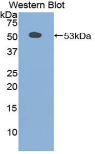 SCG2 / Secretogranin II Antibody (aa11-187, FITC)