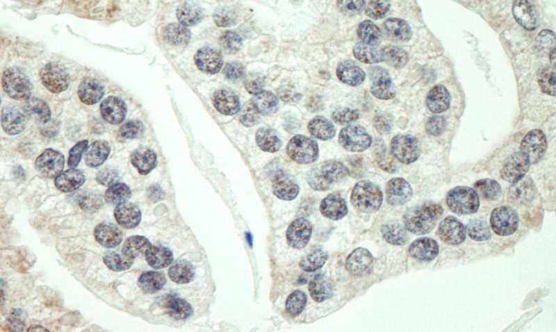 Polyclonal Rabbit anti-Human RNF40 / STARING Antibody (aa540-590, IHC, WB)