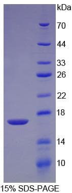 Human TGFB2 / TGF Beta2 Protein (Recombinant His-T7)