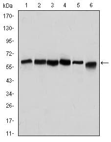 Monoclonal Mouse anti-Human BECN1 / Beclin-1 Antibody (clone 2A4, IHC, WB)