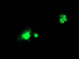 LSM1 Antibody (aa1-133, clone OTI1A9)