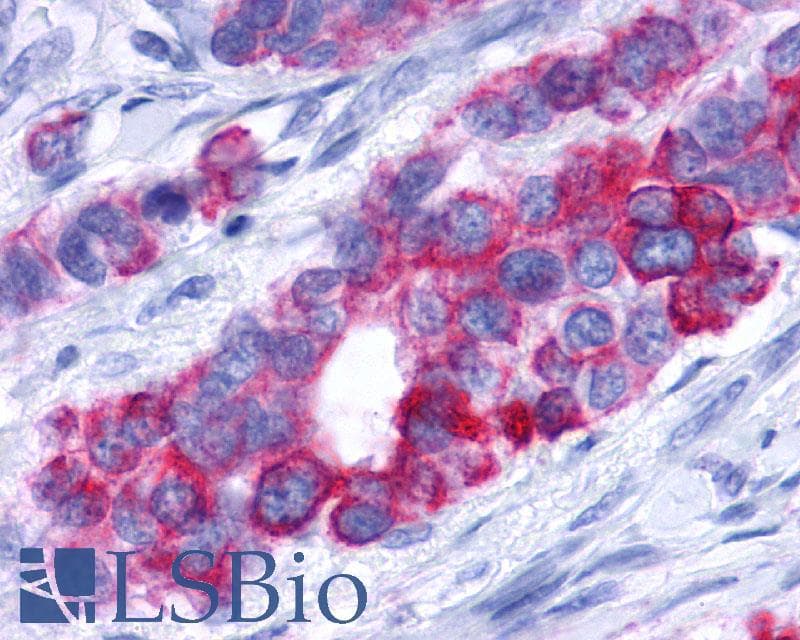 PathPlus™ Polyclonal Rabbit anti-Human GPBAR1 / TGR5 Antibody (C-Terminus, IHC)