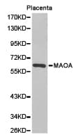 Polyclonal Rabbit anti-Human MAOA / Monoamine Oxidase Antibody (IHC, WB)