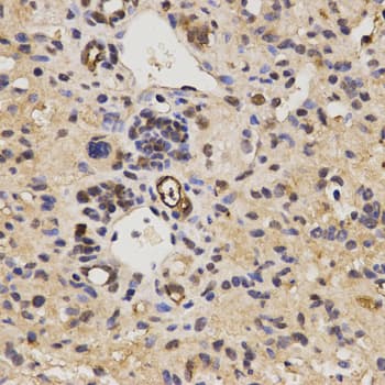 FAM160B2 / RAI16 Antibody