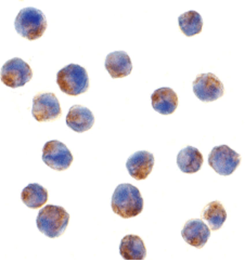 IHC-plus™ Polyclonal Rabbit anti-Human IRS1 Antibody (IHC, IF, WB)