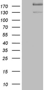 DMN / Desmuslin / Synemin Antibody (aa329-580, clone OTI7H6, Carrier-free)