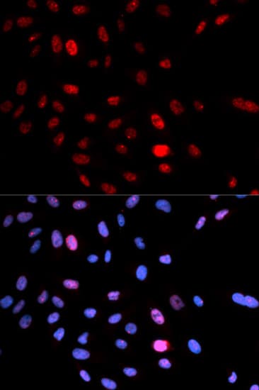 SMC1A / SMC1 Antibody (phospho-Ser957)