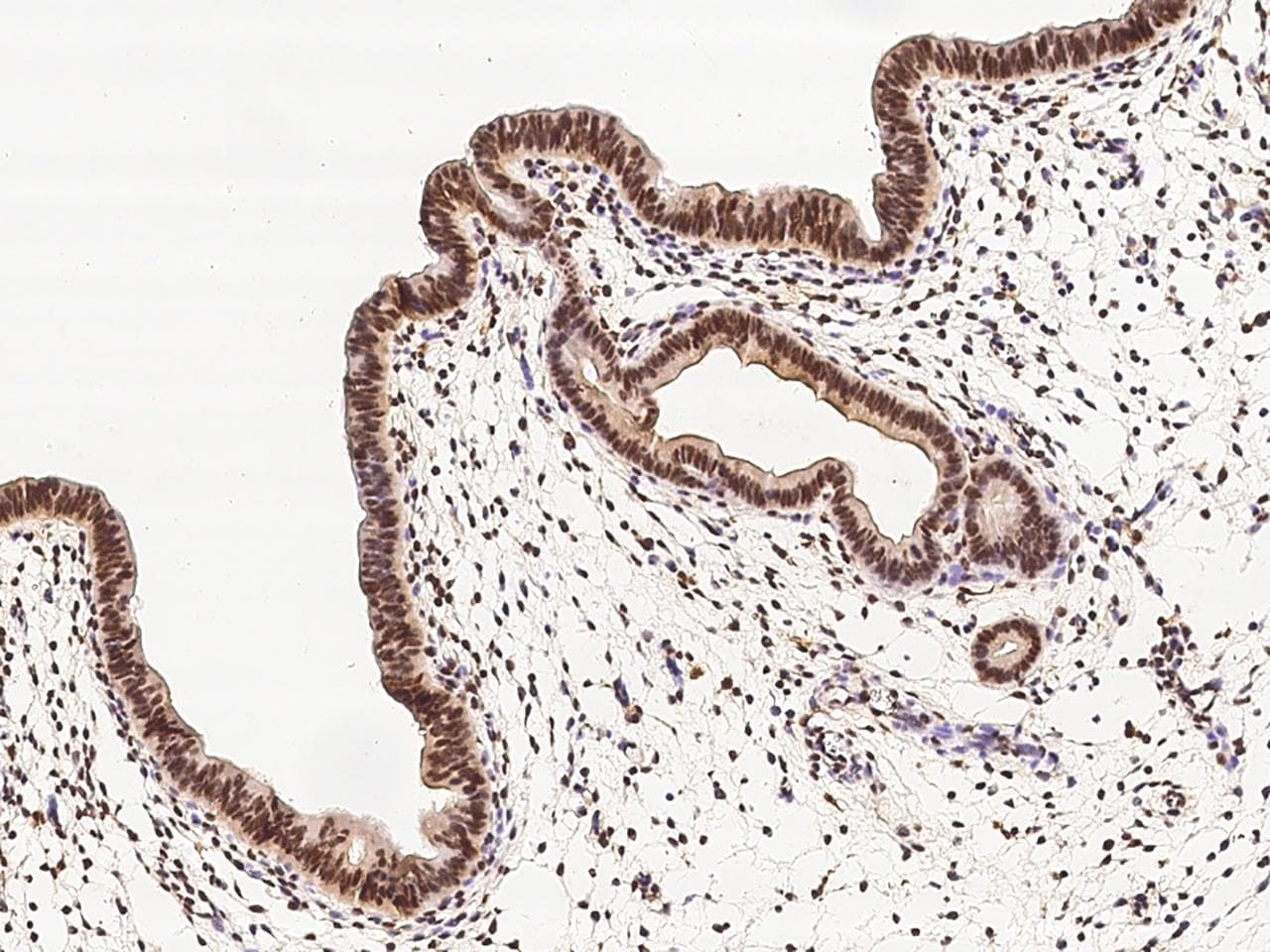 ER Alpha / Estrogen Receptor Antibody (Preservative Free)