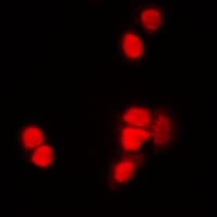 Histone H3 Antibody (Acetyl-Lys9)