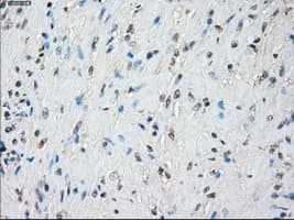 Monoclonal Mouse anti-Human BUB1B / BubR1 Antibody (clone OTI6E5, IHC, IF, WB)