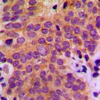 MAP3K5 / ASK1 Antibody (N-Terminus)