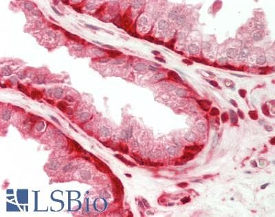 IHC-plus™ Polyclonal Rabbit anti-Human S100A6 / Calcyclin Antibody (IHC)