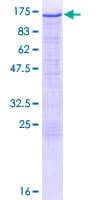 Human HK2 / Hexokinase 2 Protein (Recombinant GST)