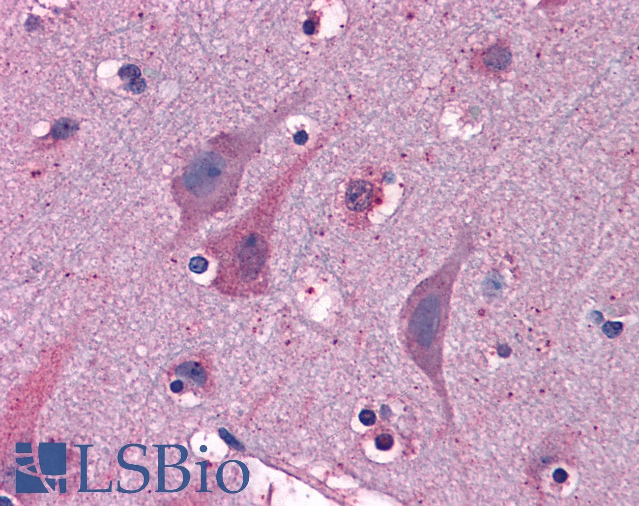 IHC-plus™ Polyclonal Goat anti-Human MYRIP Antibody (aa846-859, IHC, WB)